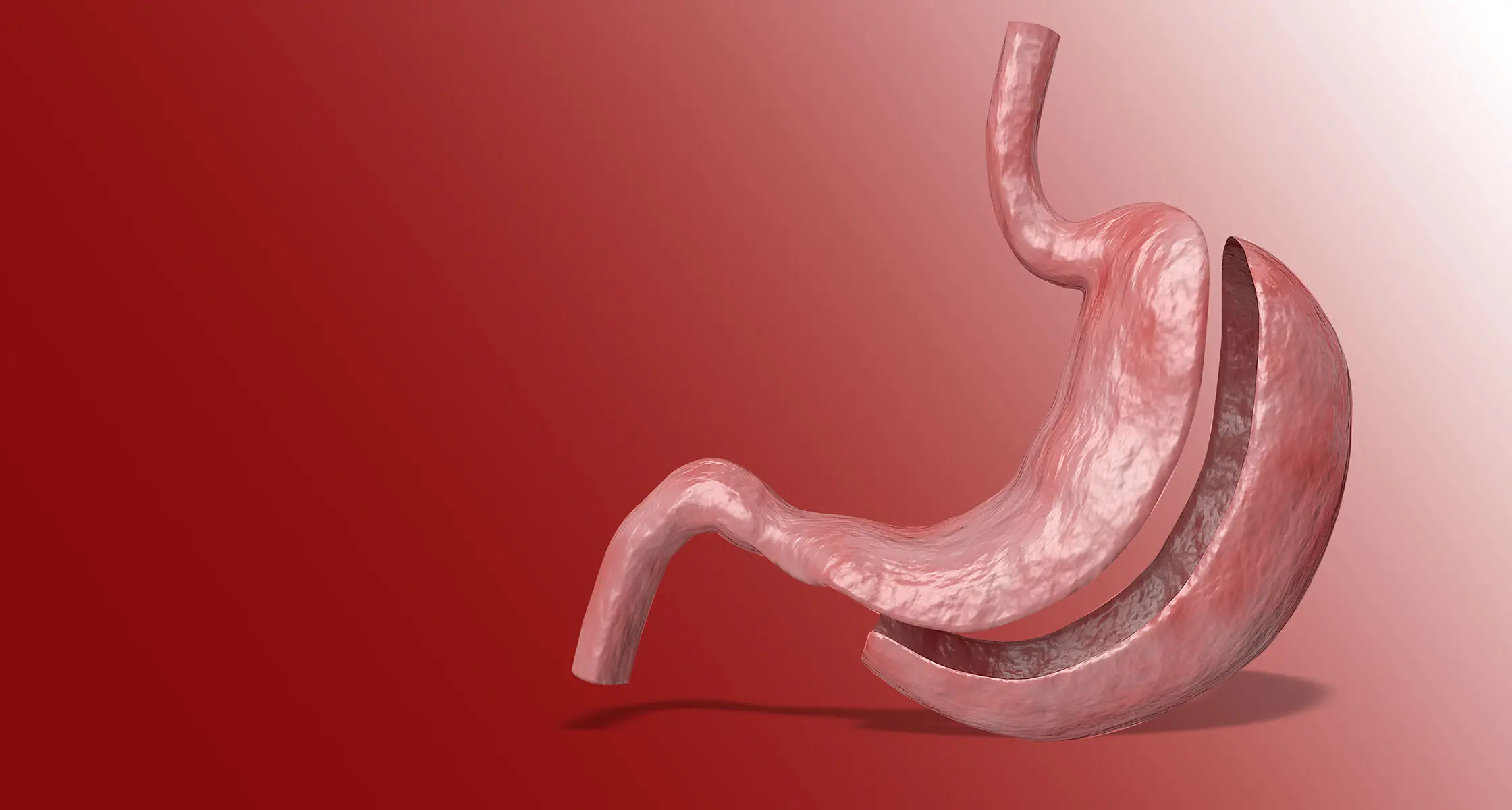 Gastric Sleeve Turkey Price Breakdown – Surgery, Hospital, and Recovery Costs